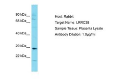 LRRC38 Rabbit anti-Human, Polyclonal, Novus Biologicals 0.1 mL | Buy Online | Novus Biologicals | Fisher Scientific